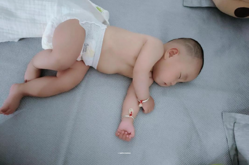 衡阳宝宝褶皱处擦粉还是油
